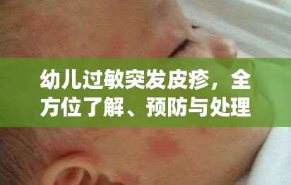 幼儿过敏突发皮疹,全方位了解、预防与处理方法
